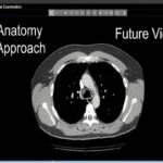 An introduction to chest CT scanning - anatomy and approach