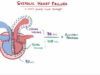 An Osmosis Video Congestive Heart Failure CHF Explained