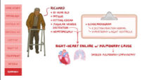 Heart failure Pathology review