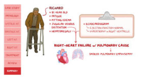 Heart failure Pathology review
