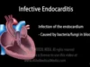 Infective Endocarditis Animation