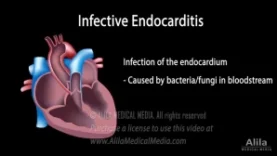 Infective Endocarditis Animation