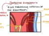 Infective Endocarditis (With Duke Criteria & Pathophysiology)