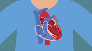 Myocarditis Causes, symptoms, diagnosis, treatment and prognosis Kenhub