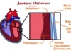 Myocarditis & Pericarditis (Myopericarditis Explained)