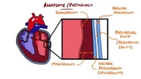 Myocarditis & Pericarditis (Myopericarditis Explained)