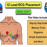 12 Lead ECG Placement MADE EASY