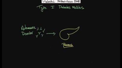 Acute complications of diabetes – Diabetic ketoacidosis