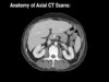 Anatomy of CT scans- Abdomen