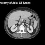 Anatomy of CT scans- Abdomen