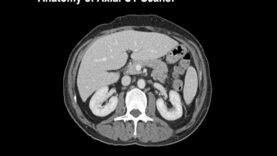 Anatomy of CT scans- Abdomen