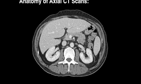 Anatomy of CT scans- Abdomen