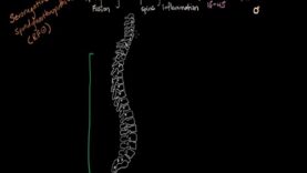 Ankylosing spondylitis – Muscular-skeletal diseases