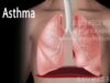 Asthma, Animation