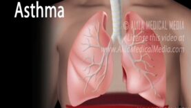 Asthma, Animation