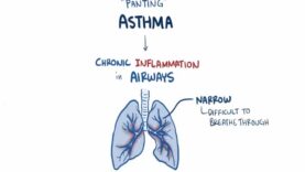 Asthma – causes, symptoms, diagnosis, treatment, pathology