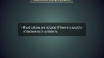 Blood cultures