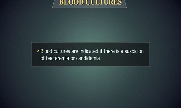 Blood cultures