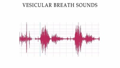 Complete Breath sounds- Normal-Abnormal Lung Sounds, Types Conditions