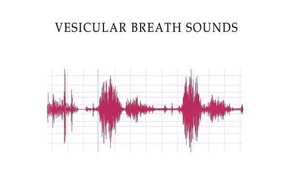 Complete Breath sounds- Normal-Abnormal Lung Sounds, Types Conditions