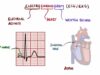 ECG Interpretation Made Easy (Learn How to Interpret an ECG in 13 Minutes)
