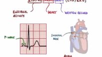 ECG Interpretation Made Easy (Learn How to Interpret an ECG in 13 Minutes)