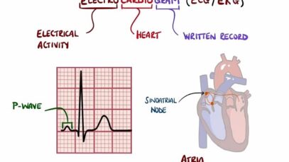 ECG Interpretation Made Easy (Learn How to Interpret an ECG in 13 Minutes)