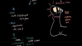 Gout and pseudogout _ Muscular-skeletal diseases