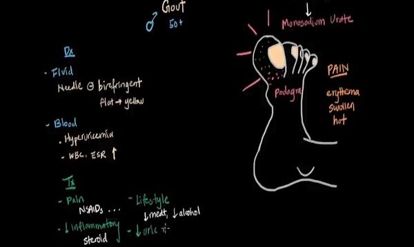 Gout and pseudogout _ Muscular-skeletal diseases