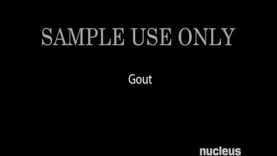 Gout1