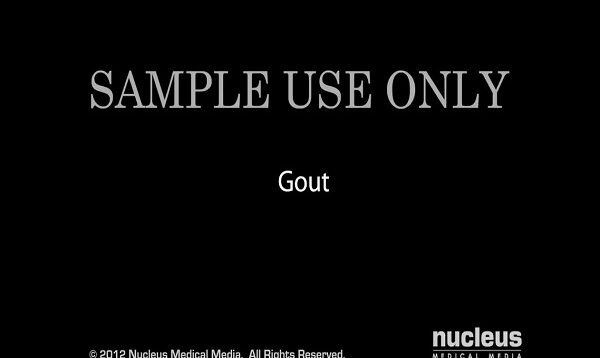 Gout1