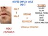 HERPES SIMPLEX VIRUS Nursing Interventions, Causes, Types1