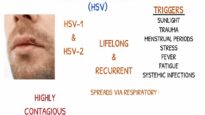 HERPES SIMPLEX VIRUS Nursing Interventions, Causes, Types1