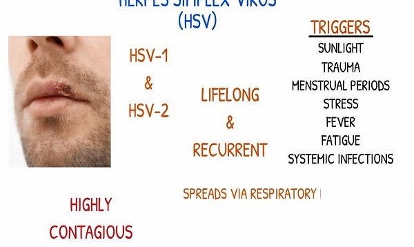 HERPES SIMPLEX VIRUS Nursing Interventions, Causes, Types1