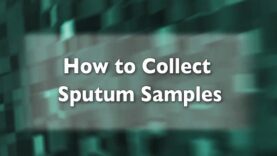 How to Collect Sputum Samples