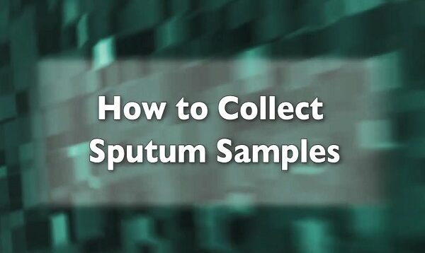How to Collect Sputum Samples
