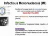 Infectious Mononucleosis (Mono) – Epstein-Barr Virus, Transmission, Symptoms, Diagnosis, Treatment