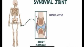 Infectious or Septic Arthritis – Causes, Symptoms, Diagnosis Treatment (Pathology)