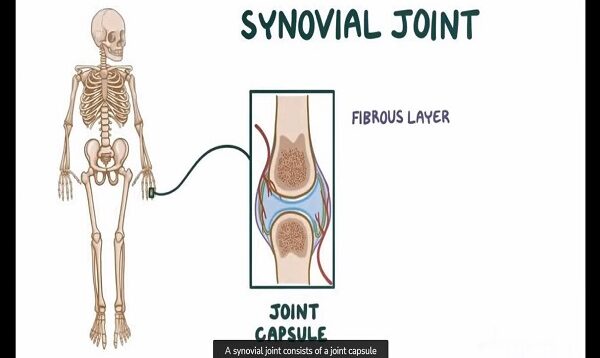 Infectious or Septic Arthritis – Causes, Symptoms, Diagnosis Treatment (Pathology)