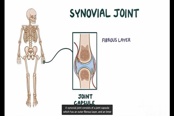 Infectious or Septic Arthritis – Causes, Symptoms, Diagnosis Treatment (Pathology)