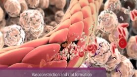 Inflammation- Immune Response to Tissue Injury or Infection