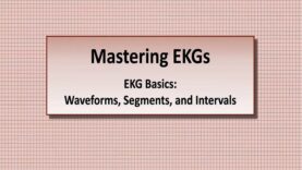 Intro to EKG Interpretation – Waveforms, Segments, and Intervals