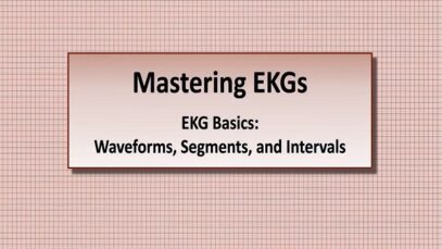 Intro to EKG Interpretation – Waveforms, Segments, and Intervals