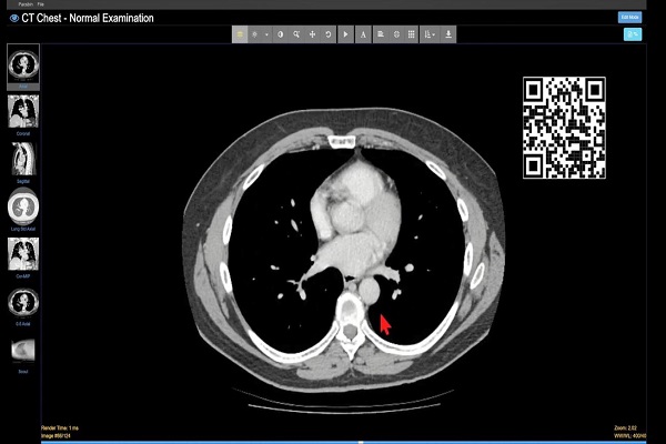 Introduction to CT Chest – Anatomy and Approach (720p60)