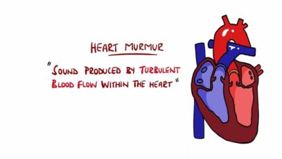 Learn Heart Murmurs In 10 Minutes (With Heart Murmur Sounds)