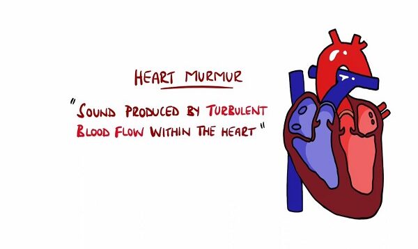 Learn Heart Murmurs In 10 Minutes (With Heart Murmur Sounds)