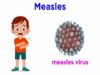 Measles (Genus Morbillivirus)