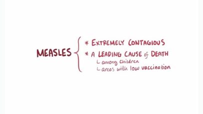 Measles – causes, symptoms, diagnosis, treatment, pathology