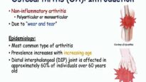 Osteoarthritis Signs Symptoms ( Why They Occur)