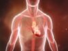 Recognizing a heart attack – 3D Animation